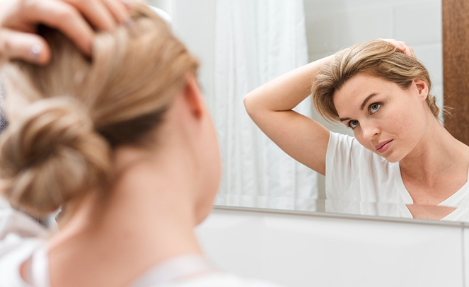 Women’s Hair Loss